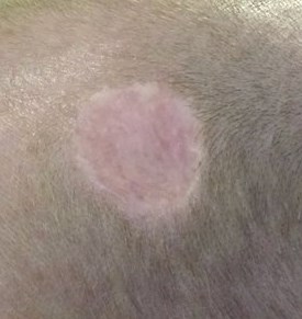  Skin Grafts