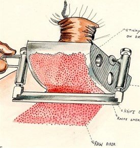 Drum Dermatome Skin Graft Harvest