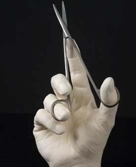 McIndoe scissors in use