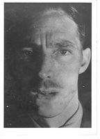 Completed initial reconstruction. Anterior view.