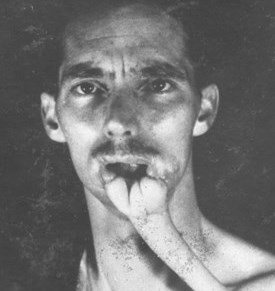 David Bye's Reconstruction