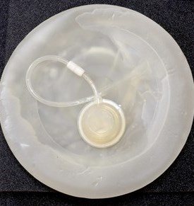"Becker" Breast Tissue Expander/Implant