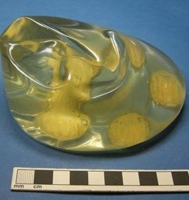 Dow Corning Silicone Breast Implant